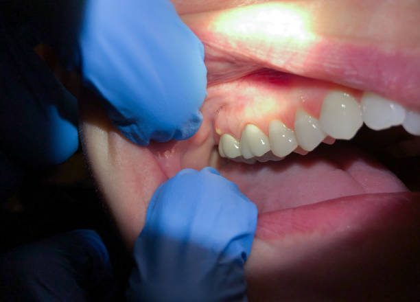 Best Urgent Dental Care in Graham, TX