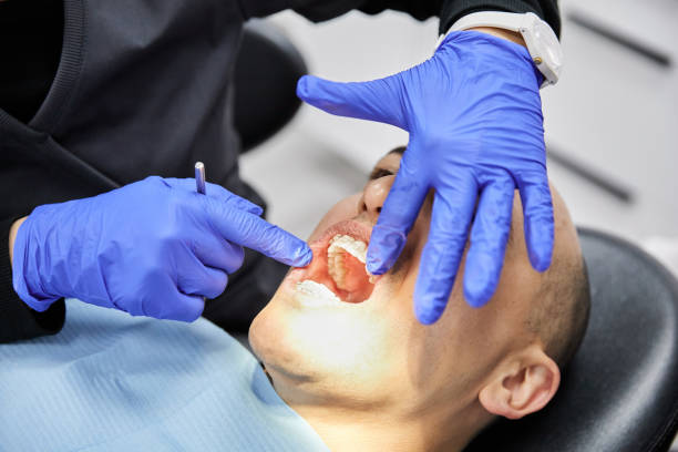 Best Emergency Root Canal Treatment in Graham, TX
